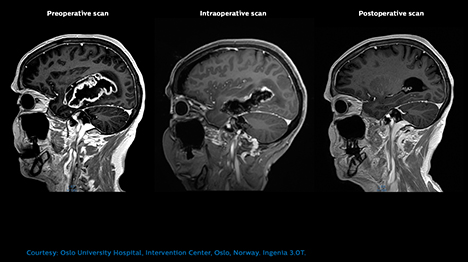 MR OR WEB 06 Intraoperative